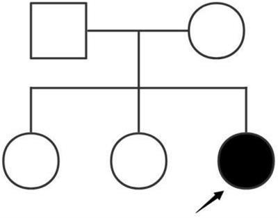 Case report and literature review: A de novo pathogenic missense variant in ACTN4 gene caused rapid progression to end-stage renal disease